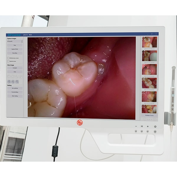 Cámara Intraoral con pantalla táctil y PM de metal. KP-CAM-One - Imagen 4